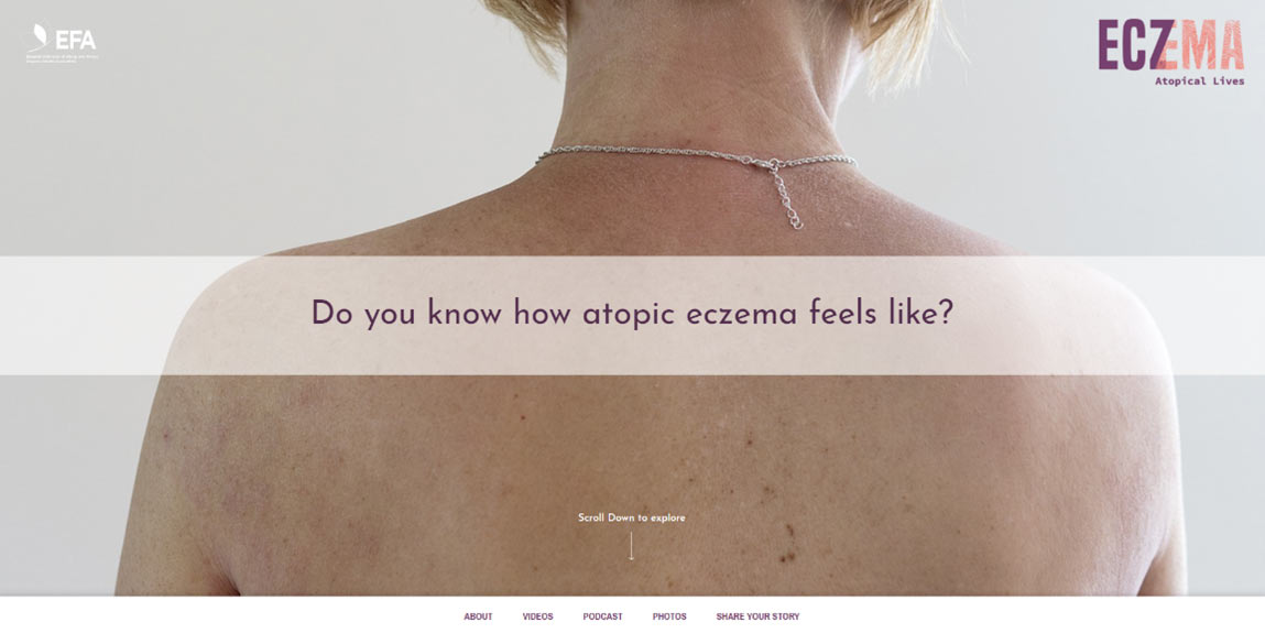 atopical lives website